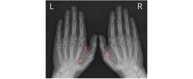 Mikrochips in der Hand von Ralf Neuhäuser Mikrochips in der Hand von Ralf Neuhäuser
